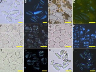 Microscopic starch grains from turmeric, ginger, sand ginger, fingerroot and galangal, showing distinctive forms that can help archaeologists identify traces of spices in ancient food residues.