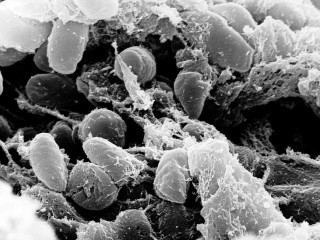 Ancient Plague Outbreaks Hit Lake Baikal Hunter-Gatherers 5,500 Years Ago